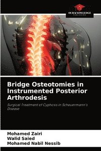 bokomslag Bridge Osteotomies in Instrumented Posterior Arthrodesis