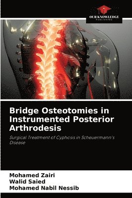 bokomslag Bridge Osteotomies in Instrumented Posterior Arthrodesis