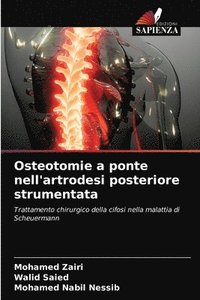 bokomslag Osteotomie a ponte nell'artrodesi posteriore strumentata