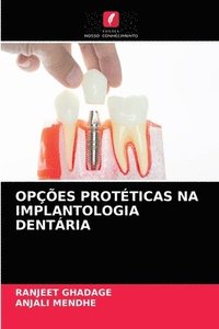 bokomslag Opes Protticas Na Implantologia Dentria