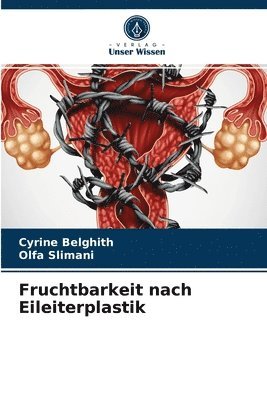 Fruchtbarkeit nach Eileiterplastik 1