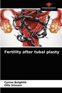 bokomslag Fertility after tubal plasty