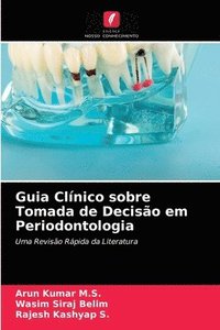 bokomslag Guia Clnico sobre Tomada de Deciso em Periodontologia