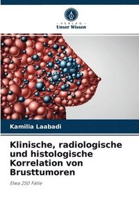 bokomslag Klinische, radiologische und histologische Korrelation von Brusttumoren