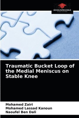 Traumatic Bucket Loop of the Medial Meniscus on Stable Knee 1