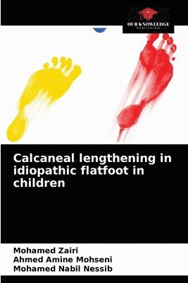 bokomslag Calcaneal lengthening in idiopathic flatfoot in children