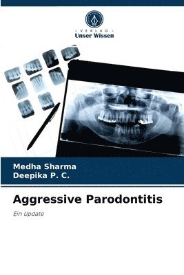 Aggressive Parodontitis 1