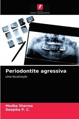 Periodontite agressiva 1
