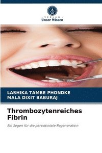 bokomslag Thrombozytenreiches Fibrin