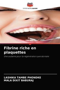 bokomslag Fibrine riche en plaquettes