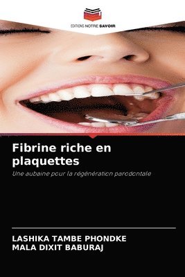 Fibrine riche en plaquettes 1