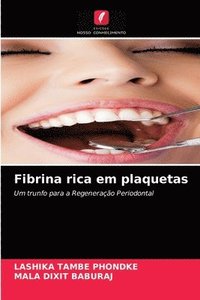 bokomslag Fibrina rica em plaquetas