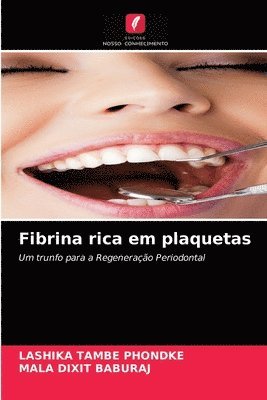 Fibrina rica em plaquetas 1