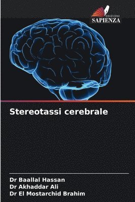 Stereotassi cerebrale 1