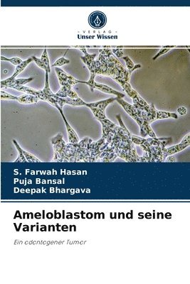 Ameloblastom und seine Varianten 1