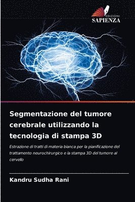 Segmentazione del tumore cerebrale utilizzando la tecnologia di stampa 3D 1