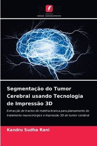 bokomslag Segmentao do Tumor Cerebral usando Tecnologia de Impresso 3D