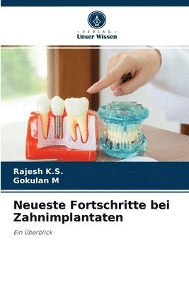 bokomslag Neueste Fortschritte bei Zahnimplantaten