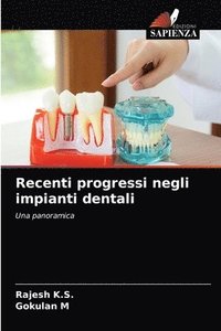 bokomslag Recenti progressi negli impianti dentali