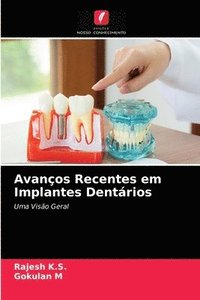 bokomslag Avancos Recentes em Implantes Dentarios