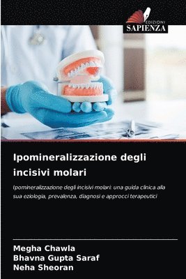 Ipomineralizzazione degli incisivi molari 1
