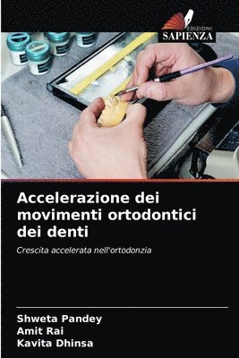 Accelerazione dei movimenti ortodontici dei denti 1