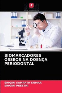 bokomslag Biomarcadores sseos Na Doena Periodontal