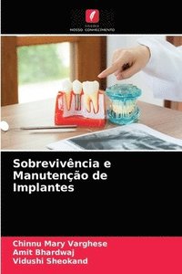 bokomslag Sobrevivncia e Manuteno de Implantes