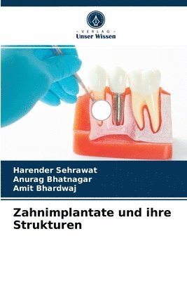 Zahnimplantate und ihre Strukturen 1