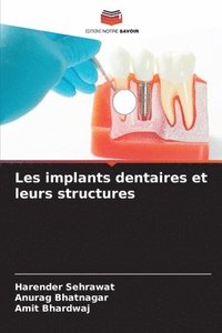 bokomslag Les implants dentaires et leurs structures
