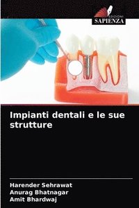 bokomslag Impianti dentali e le sue strutture