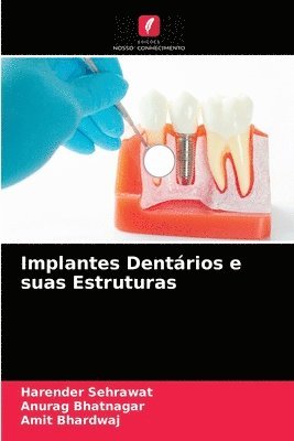 Implantes Dentrios e suas Estruturas 1