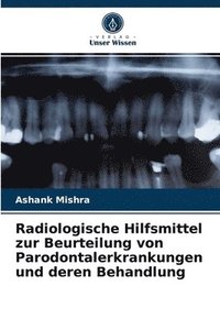 bokomslag Radiologische Hilfsmittel zur Beurteilung von Parodontalerkrankungen und deren Behandlung