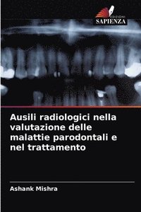 bokomslag Ausili radiologici nella valutazione delle malattie parodontali e nel trattamento