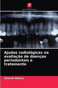 bokomslag Ajudas radiolgicas na avaliao de doenas periodontais e tratamento