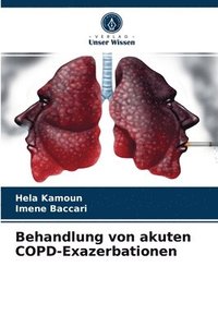 bokomslag Behandlung von akuten COPD-Exazerbationen
