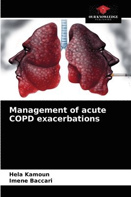 bokomslag Management of acute COPD exacerbations