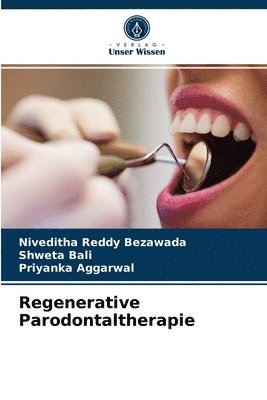 Regenerative Parodontaltherapie 1