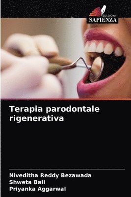 Terapia parodontale rigenerativa 1