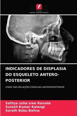 Indicadores de Displasia Do Esqueleto Antero-Posterior 1