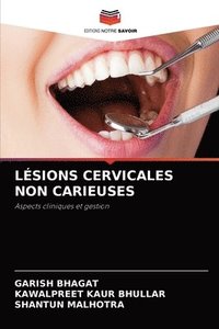 bokomslag Lsions Cervicales Non Carieuses