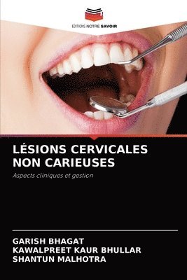 Lsions Cervicales Non Carieuses 1
