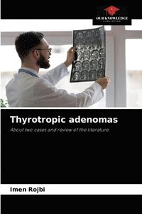 bokomslag Thyrotropic adenomas