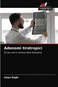 bokomslag Adenomi tirotropici