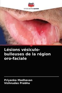 bokomslag Lsions vsiculo-bulleuses de la rgion oro-faciale