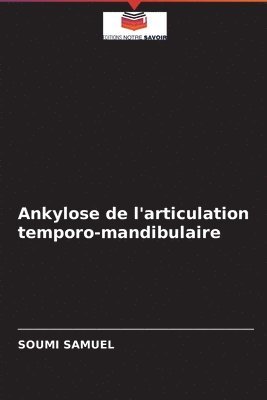 Ankylose de l'articulation temporo-mandibulaire 1