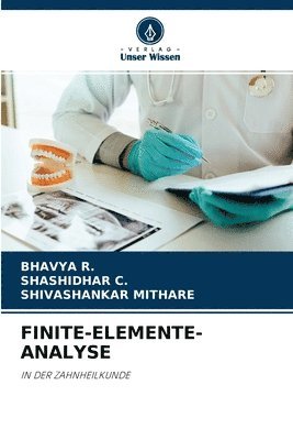 Finite-Elemente-Analyse 1