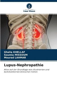 bokomslag Lupus-Nephropathie