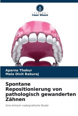 bokomslag Spontane Repositionierung von pathologisch gewanderten Zahnen