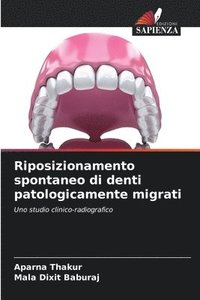 bokomslag Riposizionamento spontaneo di denti patologicamente migrati